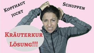 Kopfhaut juckt gereizt Schuppen  Einfache Lösung [upl. by Nahgam]