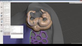 Come creare elementi complessi per odontoiatria con Autodesk Meshmixer [upl. by Mischa]