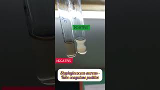 Tube coagulase test for Staphylococcus aureus staphylococcus tubecoagulase [upl. by Aicilyt976]