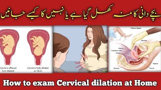 Bachydani ka muh khul gya hai ya Nahi kaisy pta lgwaenCervix OpeningDilation [upl. by Akemal313]