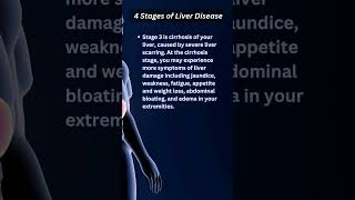 4 Stages of Liver Diseasemedical facts health [upl. by Aieki252]