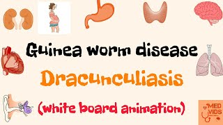 Dracunculus medinensis  Guinea worm  Parasitology  Microbiology  Med Vids Made Simple [upl. by Euphemia]