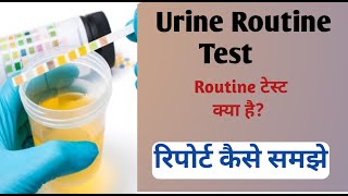 urine routine test I urine routine test report [upl. by Ahders]