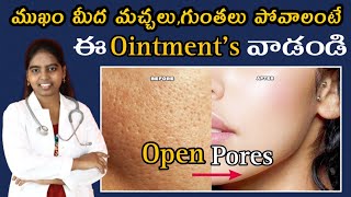 How to Remove Open Pores  Top 2 Ointments  Best Home remedies  Best Treatment Drmanogna [upl. by Lechar]