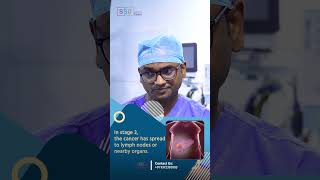 Liver Metastasis in Stage 4 Cancer Key Differences and What They Mean  Dr Praveen Kammar [upl. by Gruber]