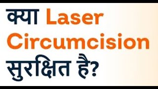 Reality of LASER CIRCUMCISION [upl. by Attela]