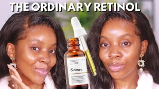 THE ORDINARY RETINOL 2 in squalene Review HOW TO CLEAR HYPERPIGMENTATION woc the Ordinary Skincare [upl. by Yesllek]