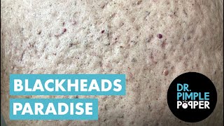 The Blackheads Paradise [upl. by Byrdie]