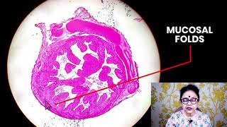 Histology of Uterine Tube Fallopian Tubes  Dr Sibani Mazumder [upl. by Laraine663]