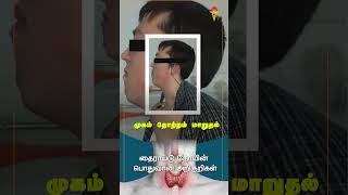 Symptoms of Thyroid  adhiparasakthihospitals tamil melmaruvathur doctor shortsvideo symptoms [upl. by Annirok]