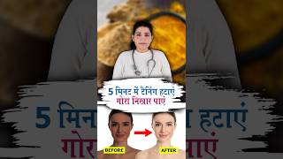 5 मिनट में टैनिंग को कहे बाय बाय इस नुस्खे से drdeepikarana skincare [upl. by Airamesor132]