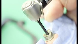 Remove a Stripped Abutment Screw in Minutes dentalimplant complications [upl. by Gordon]