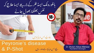 Peyronies disease and PShot With Hyaluronic Acid Filler  Dr Ghulam Abbas Mahessar  UrduHindi [upl. by Anawt]