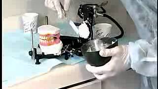 Complete Denture Procedure  21 CLINICAL REMOUNT AND OCCLUSAL REFINEMENTS [upl. by Ilehs90]