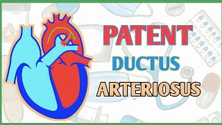 Patent ductus arteriosus PDA pathophysiology clinical features diagnosis and treatment [upl. by Awhsoj333]