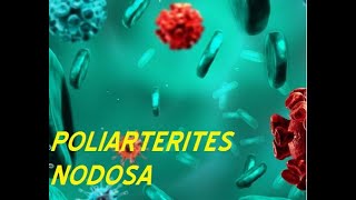 POLIARTERITIS NODOSA PATOLOGIA [upl. by Aicela]