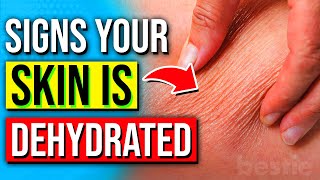 7 Signs Your Skin Is DEHYDRATED amp How To Revive It Naturally [upl. by Greenleaf200]