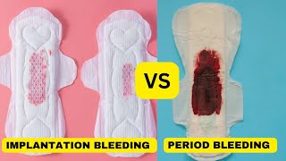 lmplantation bleeding vs periodimplantation bleedingimplantation bleeding or period [upl. by Yenalem964]