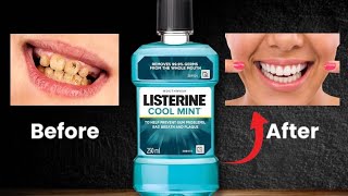 Listerine Mouthwash ❌ Cancer  Good Or Bad [upl. by Boone38]