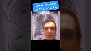 Here’s how I analyze a chest xray [upl. by Fortier]