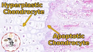 Epiphyseal Growth Plate Histology  Time to Zone Out [upl. by Leasim320]