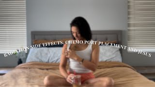 Stage 2 Rectal Cancer  Radiation  Oral Chemo side effects  Chemo Port Placement [upl. by Darrelle]