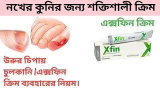 xfin cream এর কাজ কি।xfin cream ব্যবহার নিয়ম।xfin cream review in bangla [upl. by Kile]