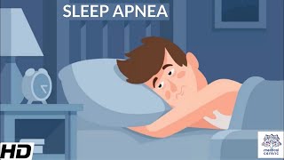 Sleep Apnea CausesSigns and Symptoms DIagnosis and Treatment [upl. by Trik]