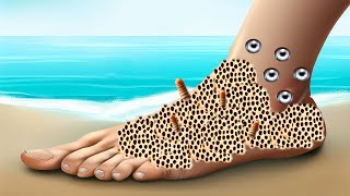 ASMR Animation Foot Treatment  Maggots Removal [upl. by Zoellick131]