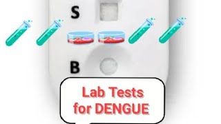 What are LAB TESTS in Dengue [upl. by Eirameinna]