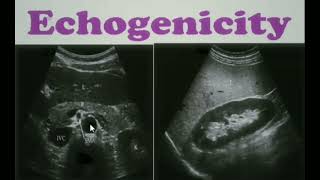 Echogenicity Ultrasound ultrasoundecgogenicity sonology [upl. by Carlton]