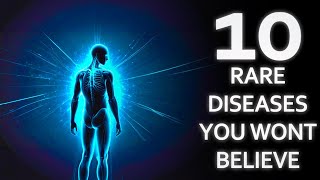 10 rare diseases you won’t believe exist [upl. by Jessalyn223]