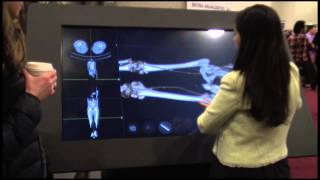 Sectra Visualization Table Demo From IMSH 2014  HealthySimulationcom [upl. by Sibylla]