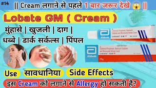 Lobate GM Neo Cream  चेहरे पर  दाग  धब्बे  मुंहासे  डार्कसर्कल  खुजली  एलर्जी  पिंपल के लिए [upl. by Chrystal]