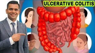 Ulcerative Colitis  Causes And Natural Treatment of Ulcerative Colitis  Dr Vivek Joshi [upl. by Buckler]