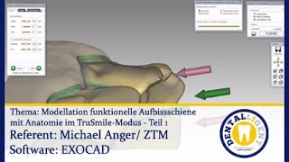 EXOCAD TUTORIAL  CADCAM  Model funkt Aufbißschiene mit Anatomie im TruSmileModus  Teil 1 [upl. by Steffane]