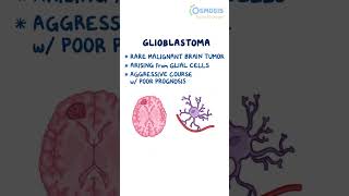 Glioblastoma [upl. by Sufur]