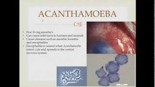 Parasitology Acanthamoeba [upl. by Cuhp]