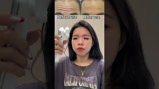 Reduce forehead wrinkles tips forehead wrinkles beautydevice beautyhacks beauty shorts [upl. by Nemhauser854]