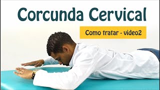 Adeus Corcunda  Como tratar a corcunda cervical  Melhore a Postura – PARTE 2 [upl. by Norahc399]