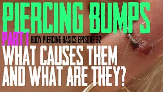 Piercing Bumps What Causes Then amp What Are They Part 1  Body Piercing Basics EP 33 [upl. by Aisekal]