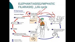 ElephantiasisLYMPHATIC FILARIASIS [upl. by Oidualc]