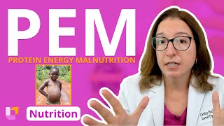 Protein Energy Malnutrition PEM Nursing School Nutrition Essentials Education  LevelUpRN [upl. by Kussell445]