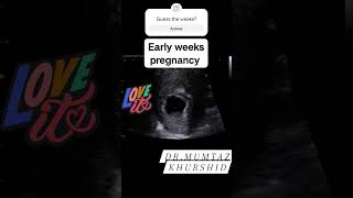 Early Weeks Ultrasound Scan In Pregnancy [upl. by Ybhsa]