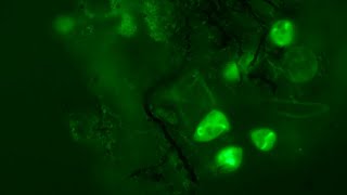 Fluorescence  Acridine Orange vs MitoTracker Green [upl. by Assiran]