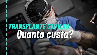 Quanto custa um transplante capilar [upl. by Dihsar]