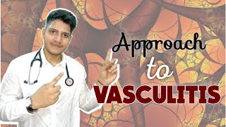 VASCULITIS  Classification  Approach  Management [upl. by Ainer547]