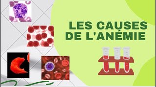 Quelles sont les causes de lanémie [upl. by Enelime767]