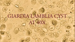 Giardia lamblia cyst under microscope at 40X [upl. by Ohl]