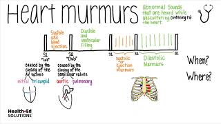 Heart Murmurs and Heart Sounds Visual Explanation for Students [upl. by Lua450]